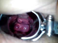 I&#039;m ginecolog my bbw wife